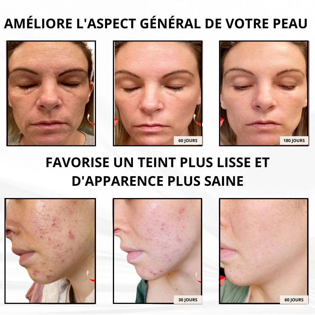 Masque LED Thérapie Lumière Rouge
