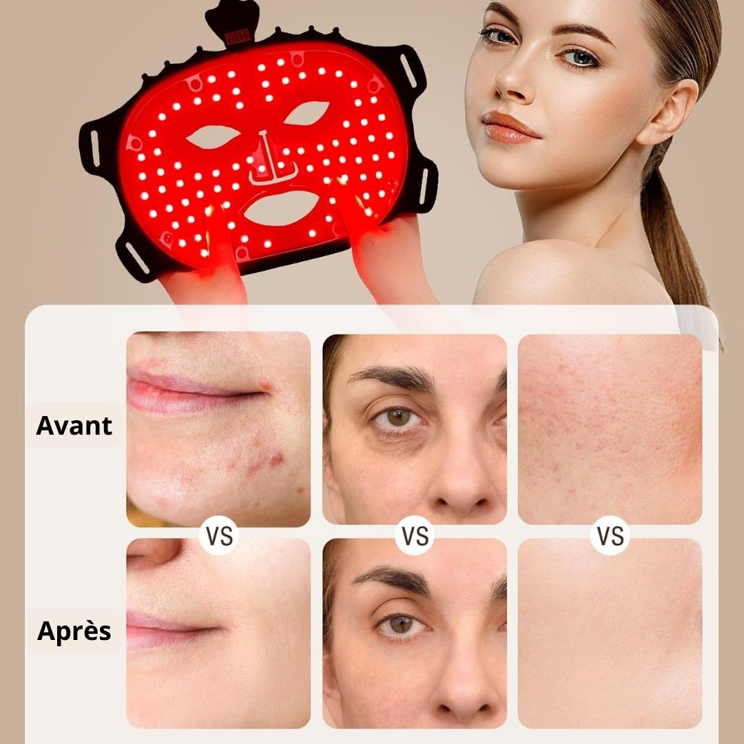 Masque LED Thérapie Lumière Rouge