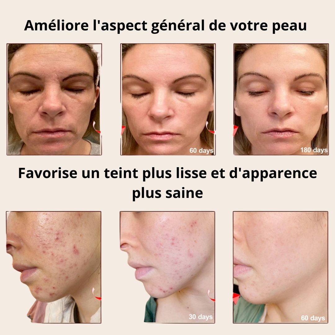 Masque LED Thérapie Lumière Rouge