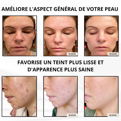 Masque LED Thérapie Lumière Rouge